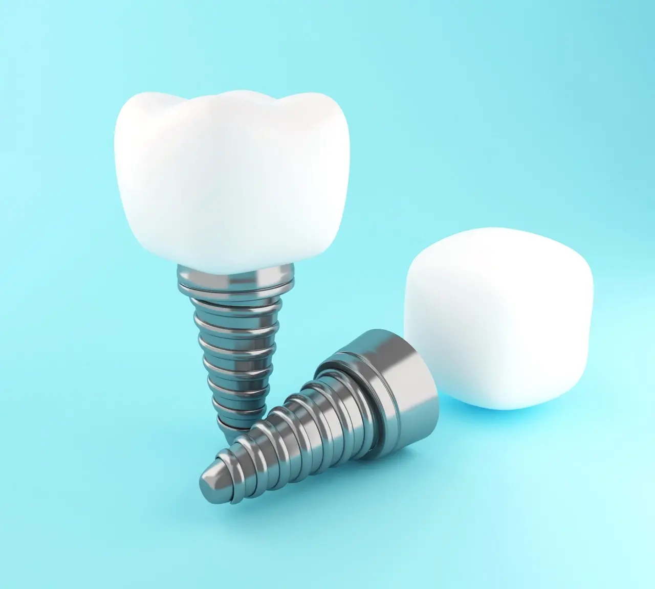 implant dentar sector 5